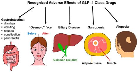 Weight Reduction with GLP-1 Agonists and Paths for Discontinuation ...