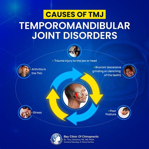 Causes Of Tmj