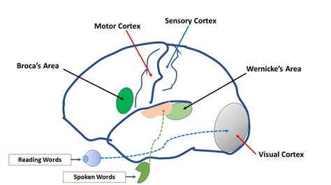 Image result for Language Mapping Awake