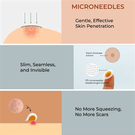 Buy Microneedle Pimple Patches Online – bbold