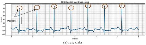 An Automated ECG Beat Classification System Using Deep Neural Networks ...