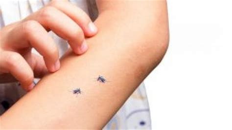 World Malaria Day: बच्चों को इस तरह रखें मलेरिया से सुरक्षित - world ...