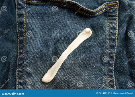 Dirty Chewing Gum Stain Removal on Cloth Jean Accident To Wash with ...