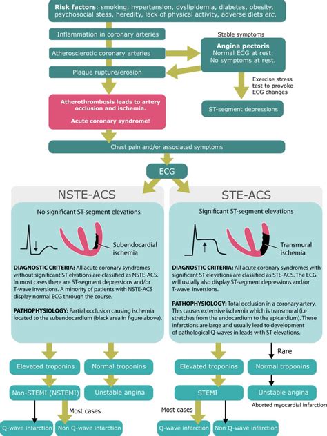 STEMI (ST Elevation Myocardial Infarction): diagnosis, criteria, ECG & management ...