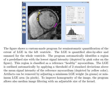 Image result for LGE Stat Tutorial