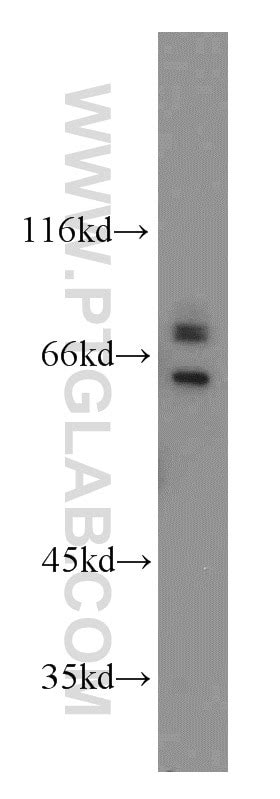 SARS antibody (15162-1-AP) | Proteintech