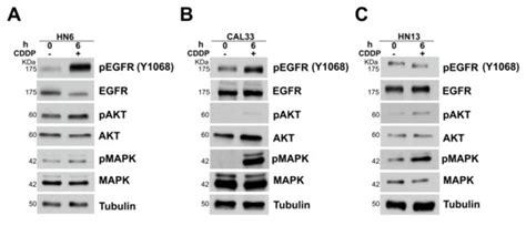 Neuropilin-1 Expression Associates with Poor Prognosis in HNSCC and ...
