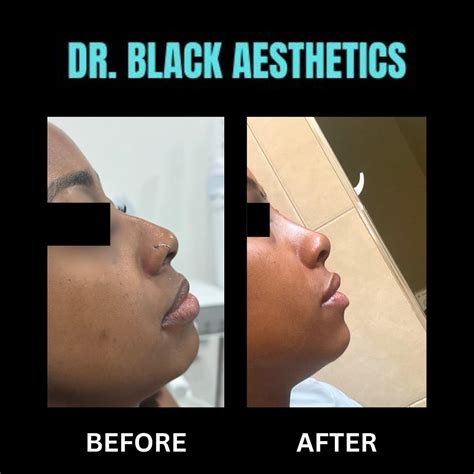 Dr. Ronaldo Black (@drblackaesthetics) • Instagram photos and videos