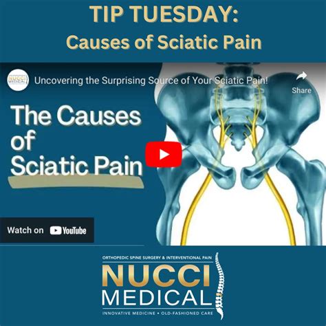 Learn about sciatic pain from Dr. Nucci | Nucci Medical - Orthopedic Spine Surgery ...