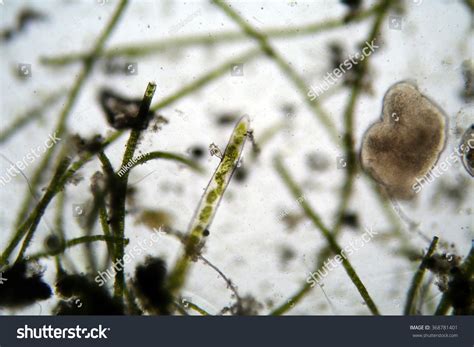 Microscopic Single Cell Animals Found Fresh Stock Photo (Edit Now ...
