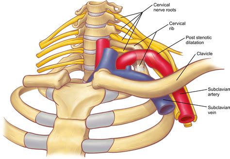 Anatomy Of Thoracic Outlet Syndrome Vascular Thoracic Outlet Syndrome