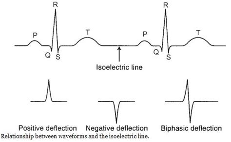 Image result for PR Interval Normal Range