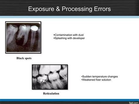 Intraoral radiographic processing and faults | PPTX