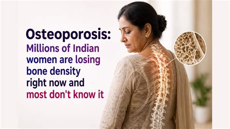 Osteoporosis: Millions of Indian women are losing bone density right ...
