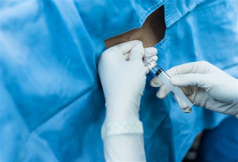 Nerve Block Injection 的图像结果