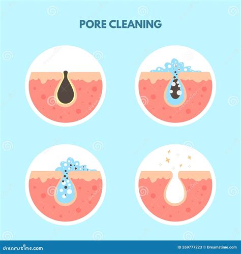 Removal Skin Blackheads. Acne Oily Skin Cleansing Process, Used Pimple ...