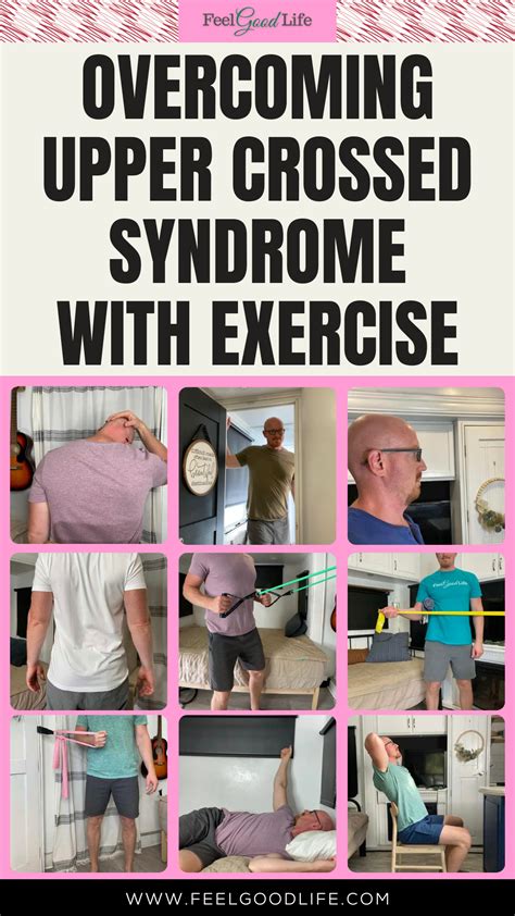 Overcoming Upper Crossed Syndrome with Exercise in 2025 | Upper cross ...