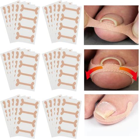 60 Sheet Professional Ingrown Toenail Corrector Patch Elastic Force Sticker Repair Bandage ...