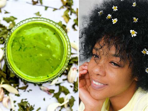 3 DIY Homemade Hair Masks to Get Rid of Dandruff & a Flaky Scalp ...