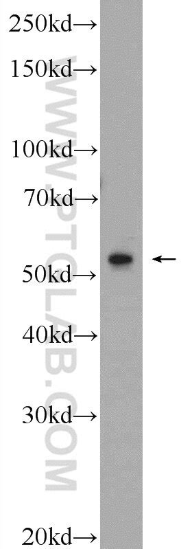 ERG antibody (14356-1-AP) | Proteintech
