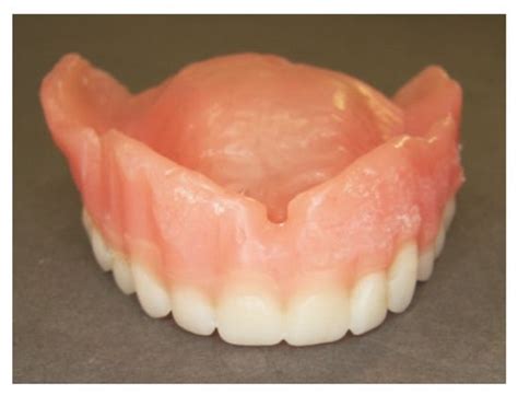 Current Status of Digital Complete Dentures Technology