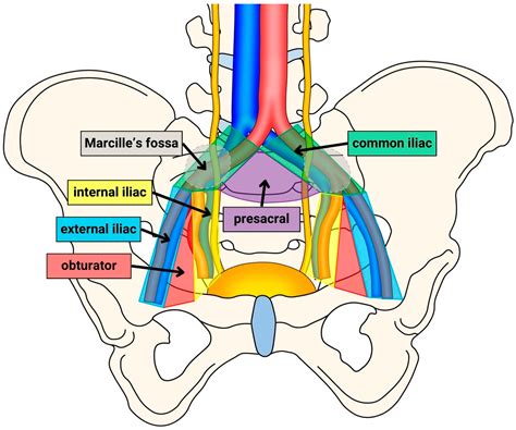 Topography and Lateralization of Nodal Metastases in Muscle-Invasive Bladder Cancer Using Super ...