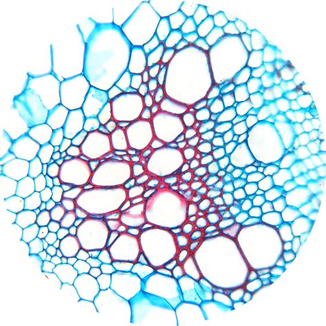 Why Is Xylem Tissue Important at Delores Perry blog
