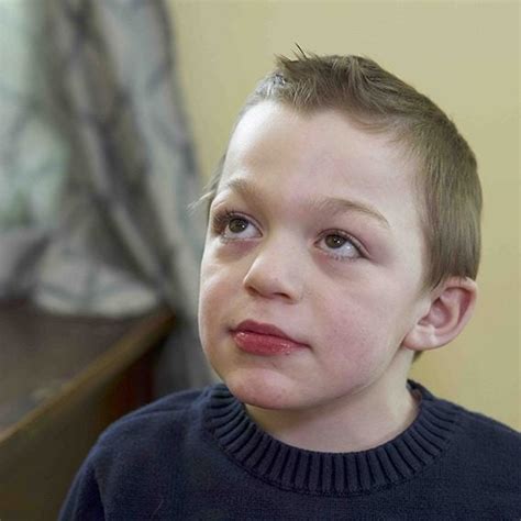 How is Hunter Syndrome Diagnose? Tests & Early Detection