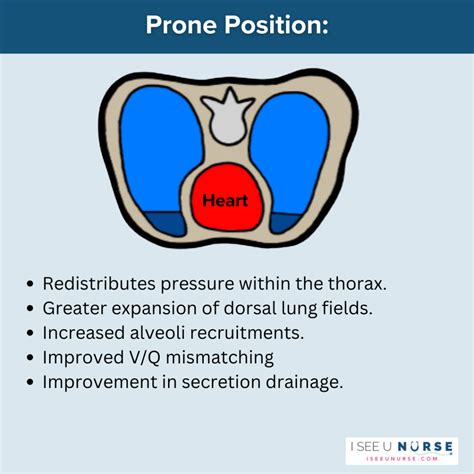 Proning for Critical Care Nurses - ISeeU_Nurse with Sarah Vance