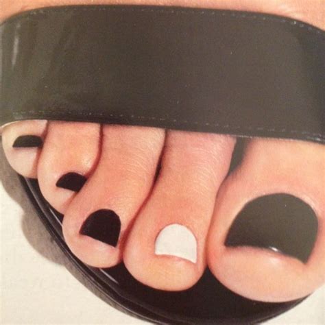 white spots on toenails after removing nail polish