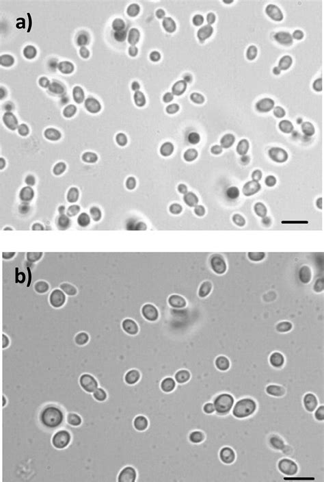 Budding Yeast Cells Under Microscope
