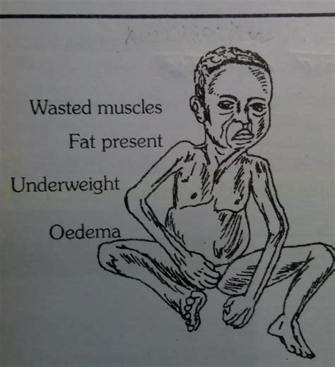 [tex]{\Large{\underline{\underline{{\textsf{\textbf{Question ...