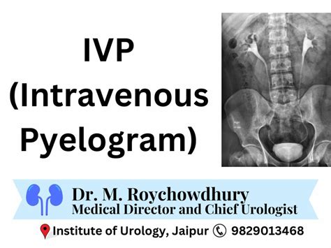 Image result for Normal Intravenous Pyelogram