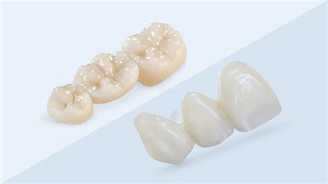 Wahl zwischen Transformationsbeständigkeit und Lichtdurchlass ...