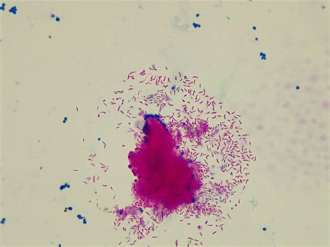 Micrograph Escherichia coli and Mycobacterium smegmatis acid fast 1000X ...