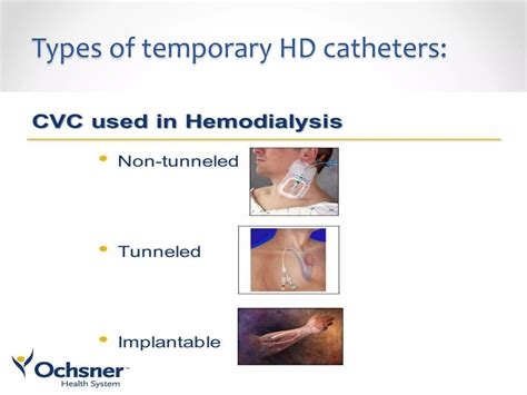 Brief pathway to handle temporary HD catheter | PPTX