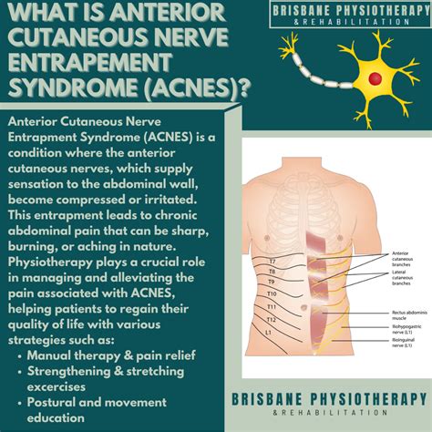 Abdominal Cutaneous Nerve Diagram