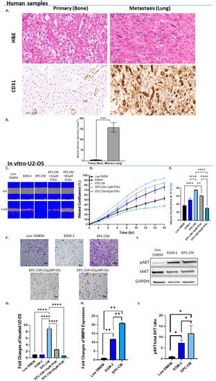 Endothelial Progenitor Cells Promote Osteosarcoma Progression and ...