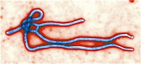 埃博拉病毒性出血热疫情（28/08/2014）及本次疫情病毒株序列的测定 - 知乎