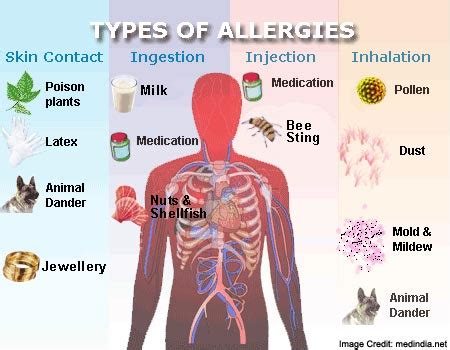Allergies: Types, Symptoms, Causes, Risk Factor and Treatments
