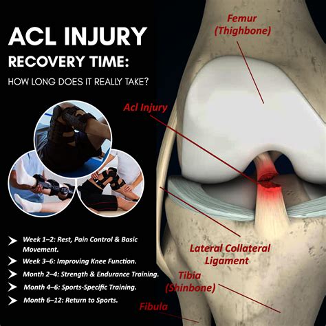 ACL Injury Recovery Time: How Long Does It Really Take?