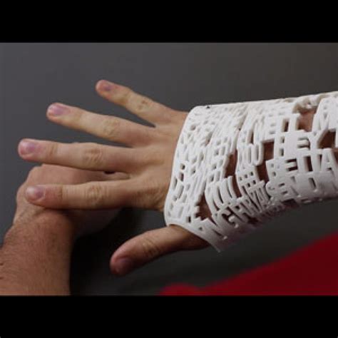 3d printed plastic cast looks awesome and uses ultrasound to heal ...