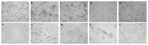 Cytotoxic Activity of Origanum Vulgare L. on Hepatocellular Carcinoma ...