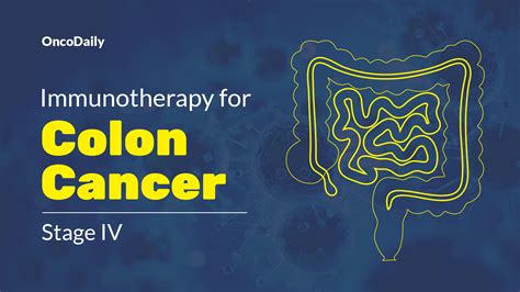 Immunotherapy for Metastatic Colon Cancer: Types, Success Rate, Side Effects & More - OncoDaily