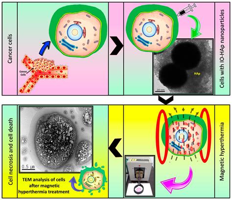 Hydroxyapatite Coated Iron Oxide Nanoparticles: A Promising ...