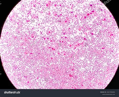 Neisseria Gonorrhoeae Species Gram-negative Diplococci Bacteria Stock ...
