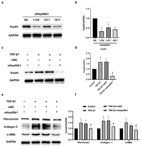 MiR-148a-3p within HucMSC-Derived Extracellular Vesicles Suppresses ...