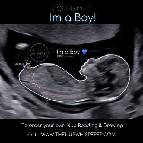 baby boy at 14 weeks ultrasound - Marylyn Luciano