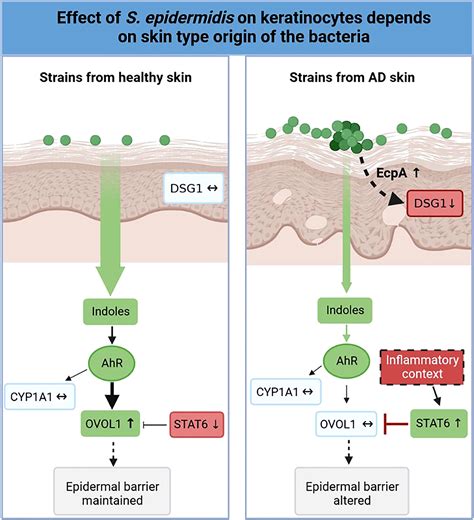 Staphylococcus Epidermidis Signs And Symptoms Full Article: The