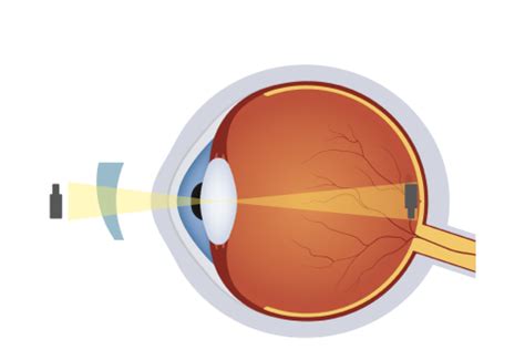 Aditya Eye Clinic